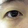 Ryan's eye